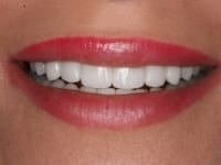 Konig Center for Cosmetic & Comprehensive Dentistry smile photos